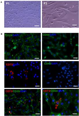 CD73+ Mesenchymal Stem Cells Ameliorate Myocardial Infarction by Promoting Angiogenesis